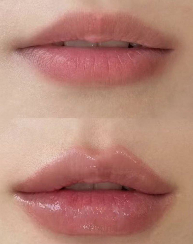 三、遗传倾向：疤痕体质的潜在“密码”