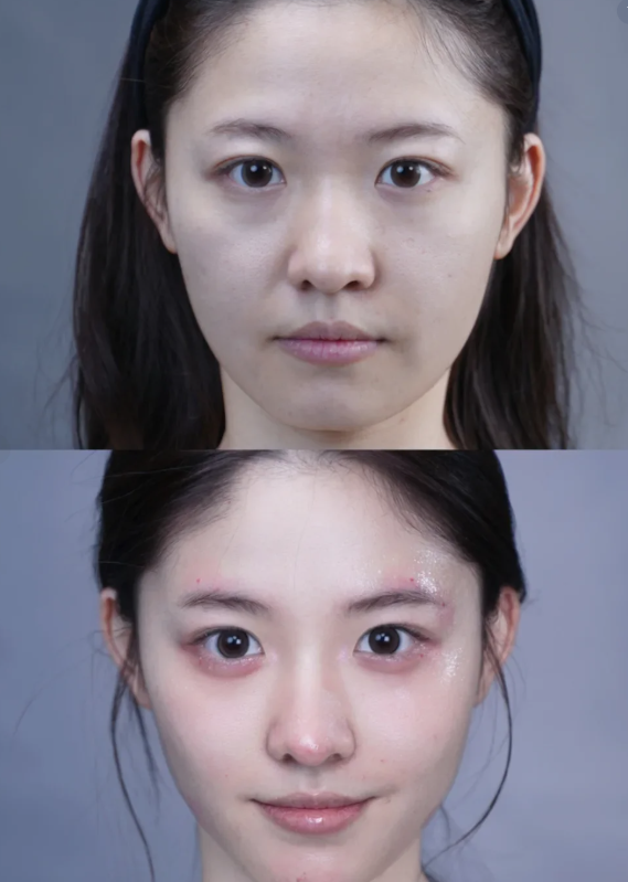 五、疤痕体质的伴随不适：易被忽视的细节症状