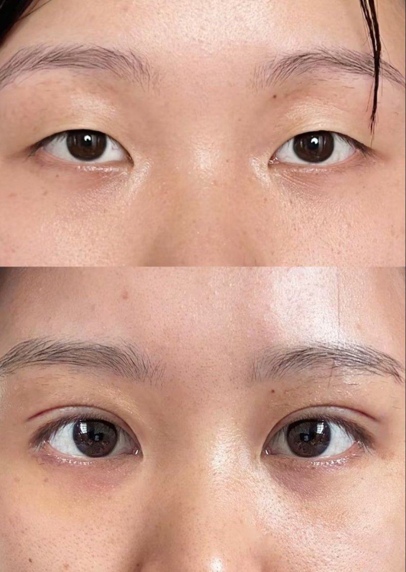 襄阳悦美整形怎么样？