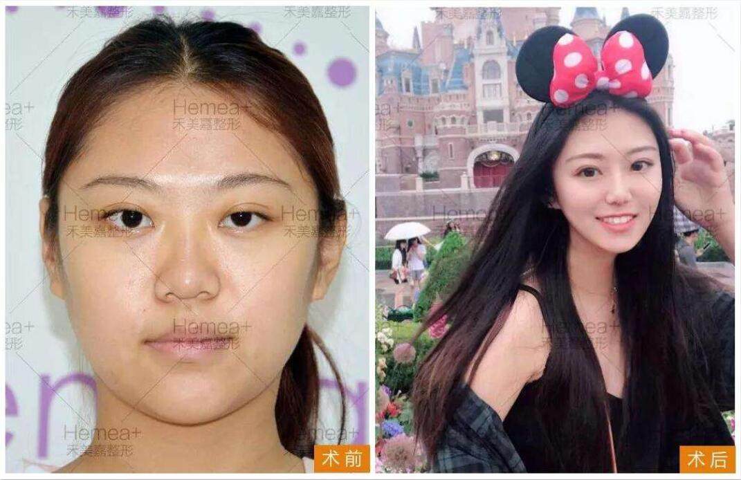 二、刘娟娟医生:专精资质加持的注射操作保护