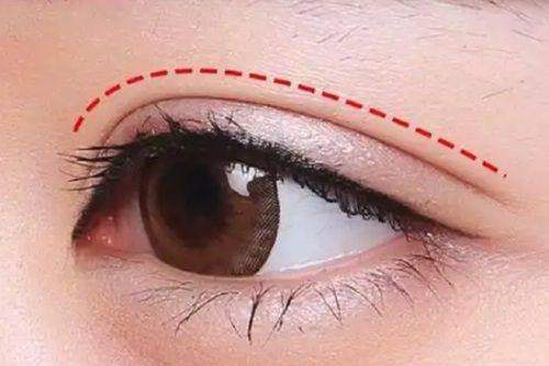 深圳阳光医美(万象天地分院)预约挂号方式: