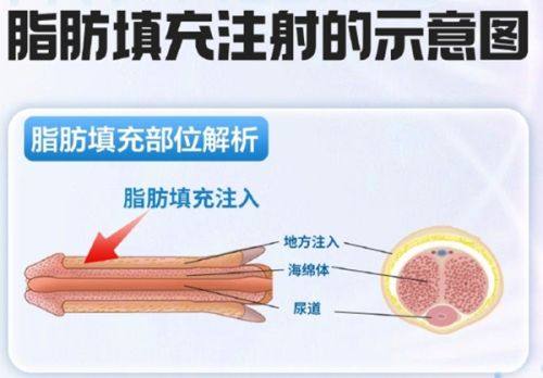 二、不同阶段擦伤疤痕的药膏选择攻略