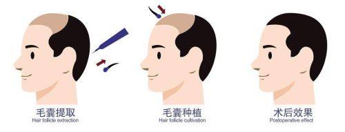 三、去除擦伤疤痕的“黄金药膏搭配”思路