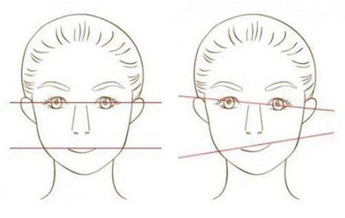三、不同类型凸起疤痕的应对方案