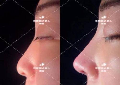 南宁珍善美医疗美容预约挂号方式：