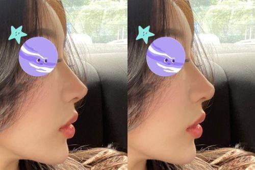 韩国theall medical hub整形外科预约挂号方式：