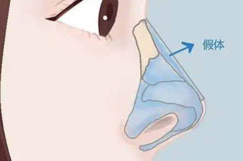 南宁珍善美医疗美容口碑评价：