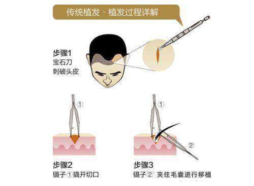 深圳阳光医美(万象天地分院)口碑评价: