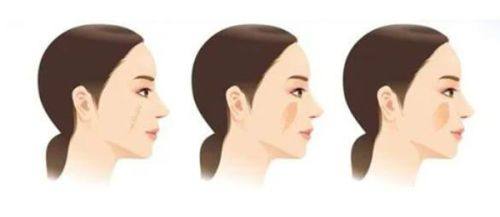 四、做好眼部护理，快速缓解肿眼泡浮肿