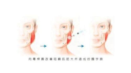 按摩促循环：去眼袋黑眼圈的隐形小窍门