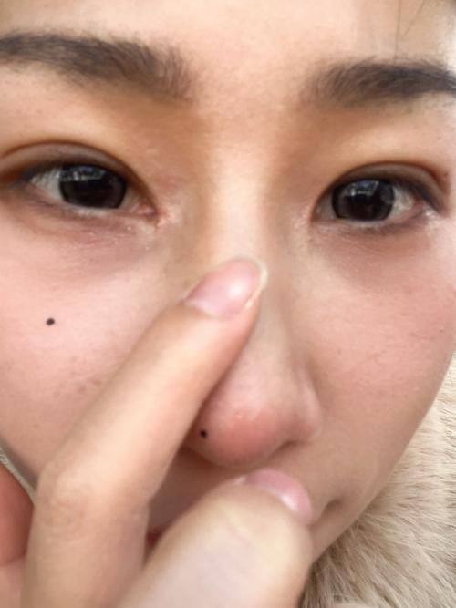 李庆意医生擅长领域