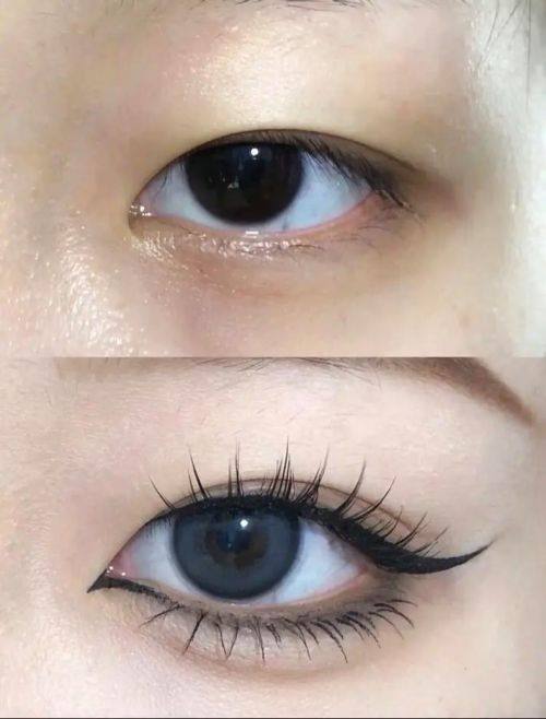 李庆意医生技术优势