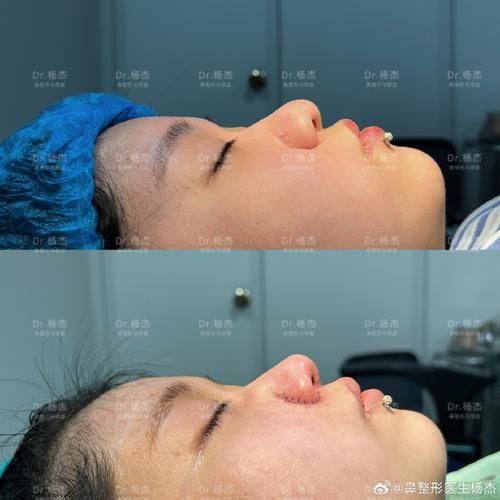 深圳阳光医美(万象天地分院)价格表: