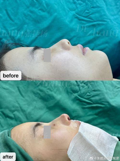 郑州美莱整形医院预约挂号方式: