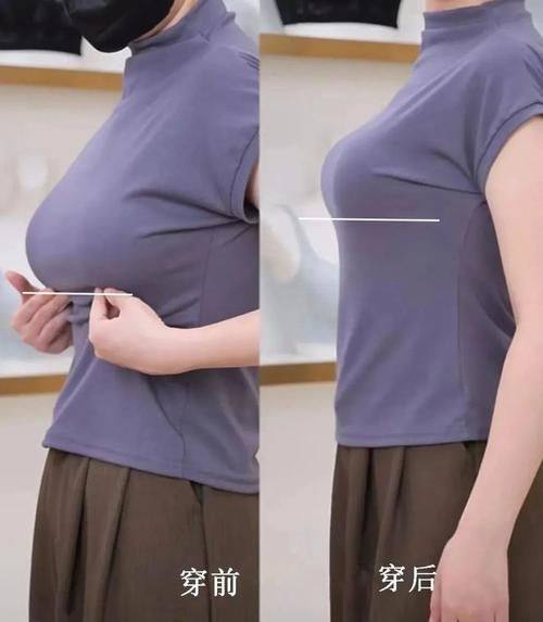 陶红医生技术优势：