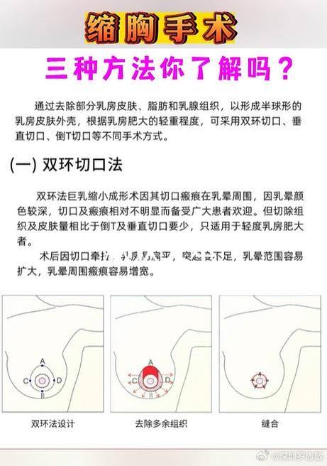 陶红医生擅长领域：