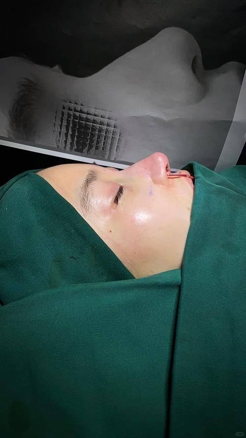 陶红医生怎么预约？