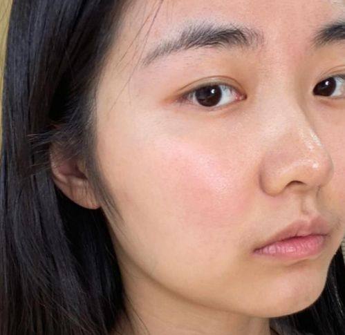 庆阳市人民医疗美容科擅长项目：