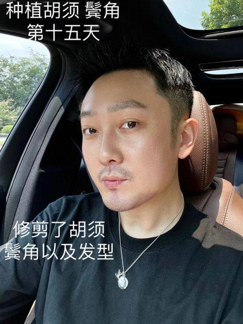 佳木斯李景林医疗美容诊所口碑评价：