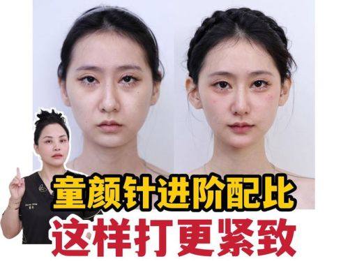 南宁珍善美医疗美容擅长项目：