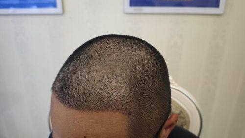 深圳阳光医美(万象天地分院)怎么样?