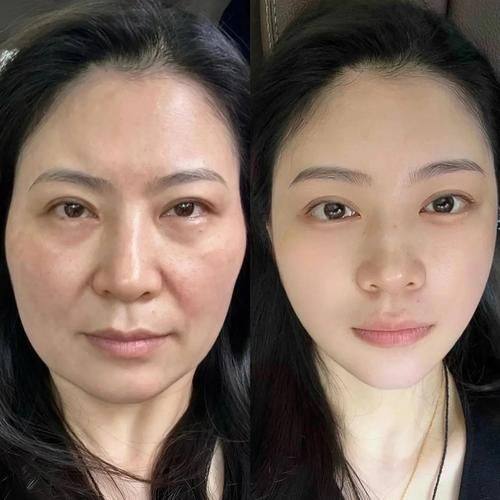 潘虹医生口碑评价：