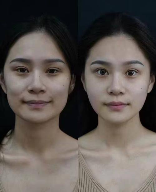 潘虹医生技术优势：