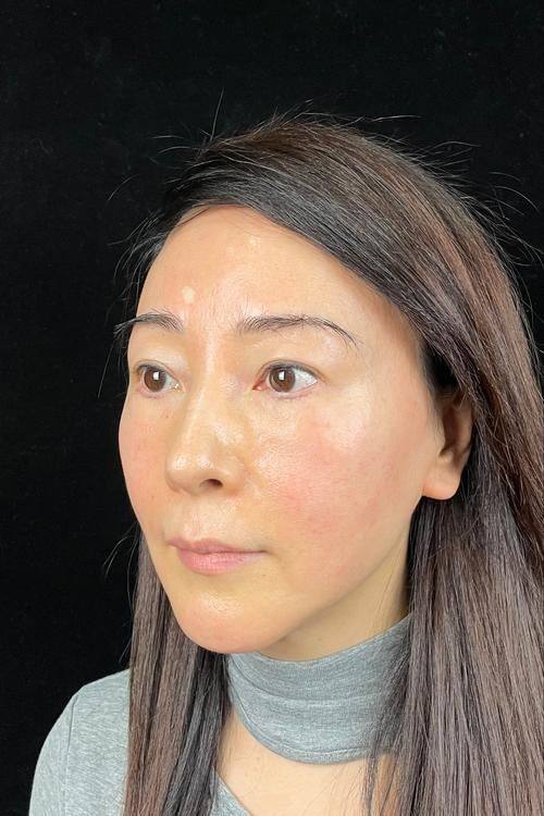 郑州美莱整形医院医生名单及擅长领域: