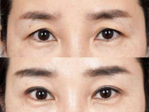 怀化夏韩医疗美容诊所擅长项目: