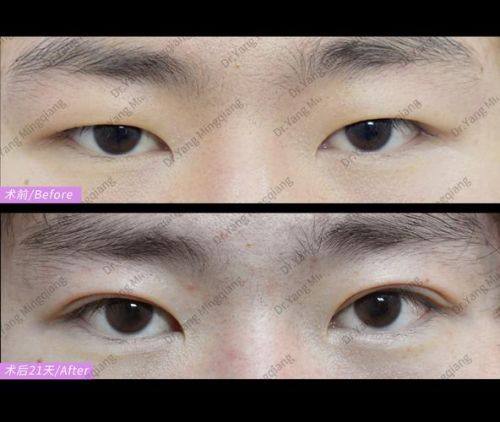 李健刚医生技术优势