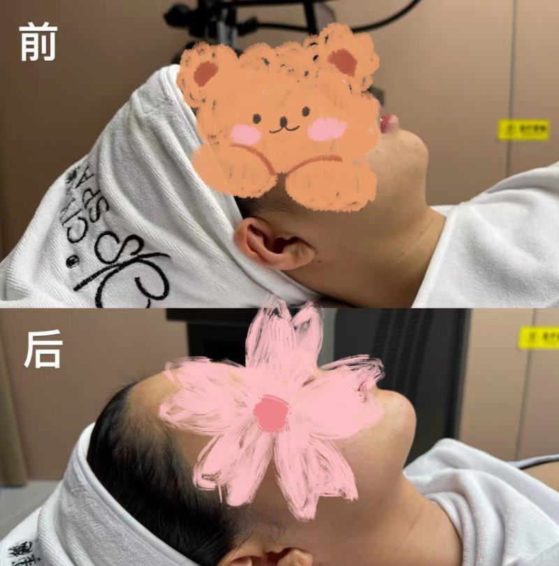 南宁珍善美医疗美容怎么样？