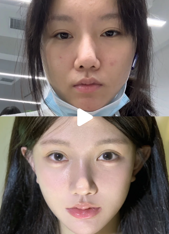 南宁珍善美医疗美容价格表：