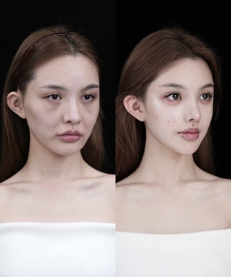 二、调整作息习惯，从根源减少肿眼泡生成