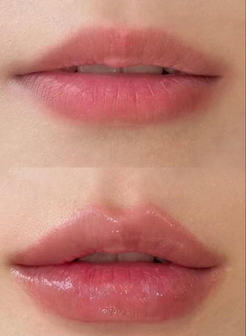 韩国theall medical hub整形外科怎么样？