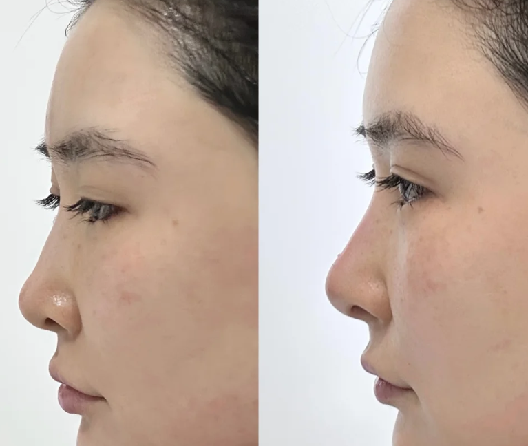 中医内调外养：从根源改善眼袋黑眼圈