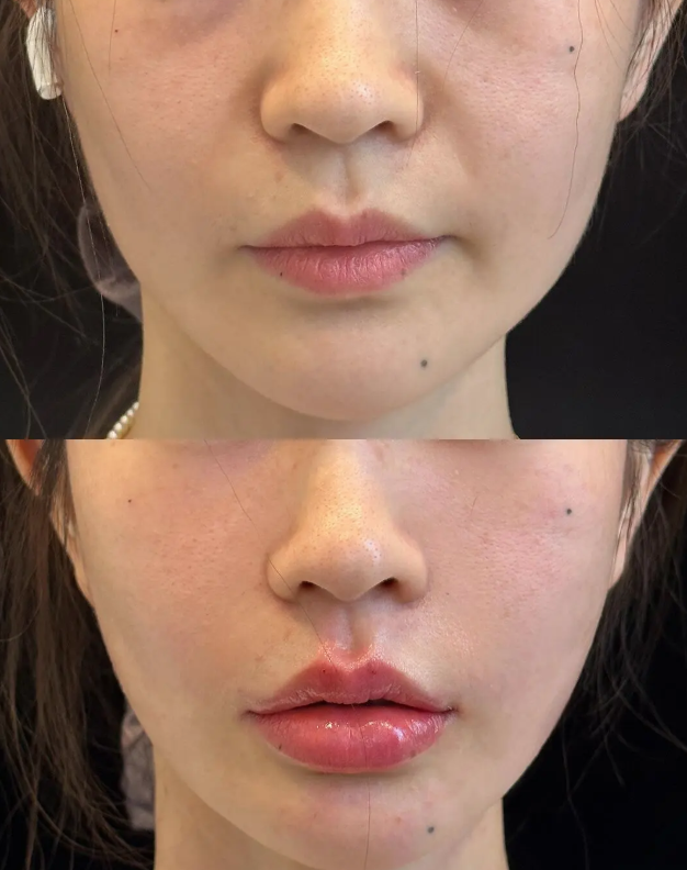 庆阳市人民医疗美容科口碑评价