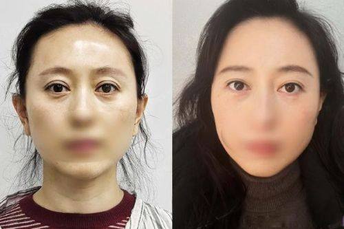 常州第一人民医院整形科地址电话及营业时间：