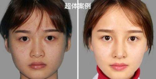 上海丽宣医疗美容门诊部地址电话及营业时间：