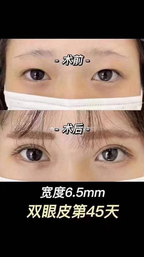 盐城仁美美容整形外科诊所口碑评价