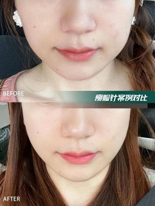 盐城仁美美容整形外科诊所怎么样？