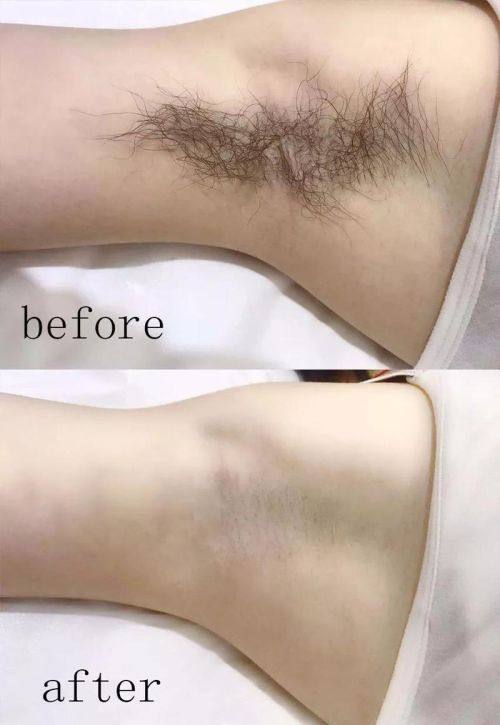 涿州天媛整形美容诊所地址电话及营业时间：