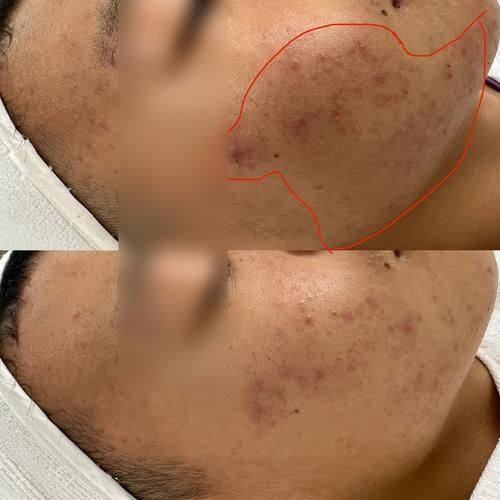 涿州天媛整形美容诊所擅长项目：