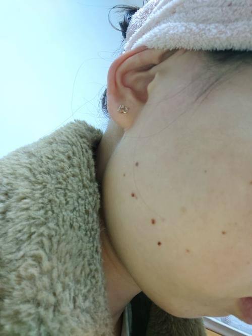 深圳招美医疗美容门诊部怎么样？