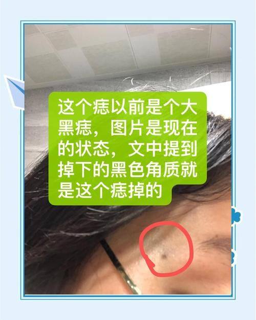 涿州天媛整形美容诊所怎么样？