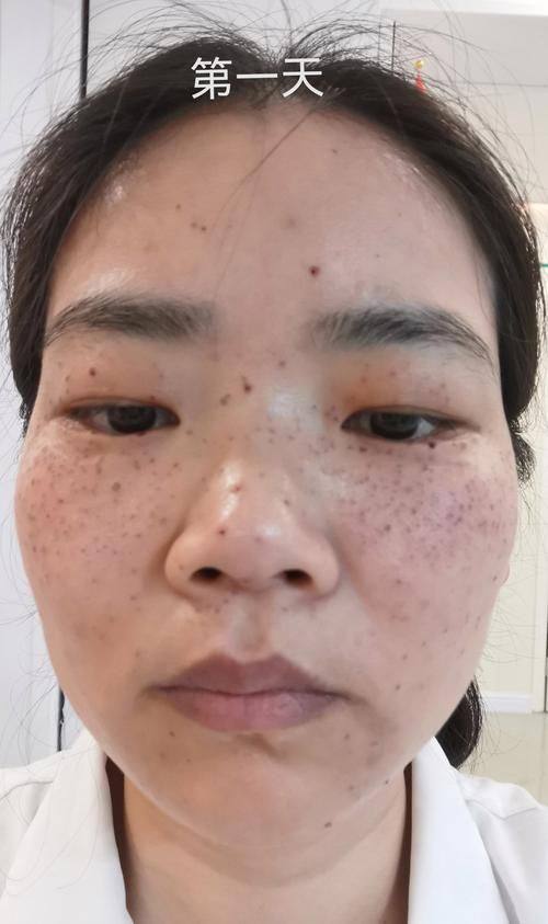 涿州天媛整形美容诊所预约挂号方式：