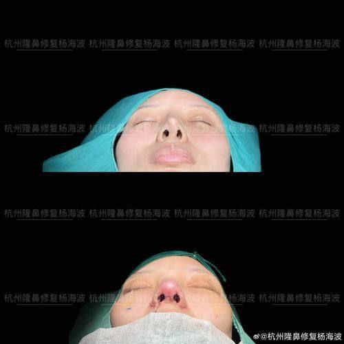 重庆杨洋医疗美容诊所擅长项目：