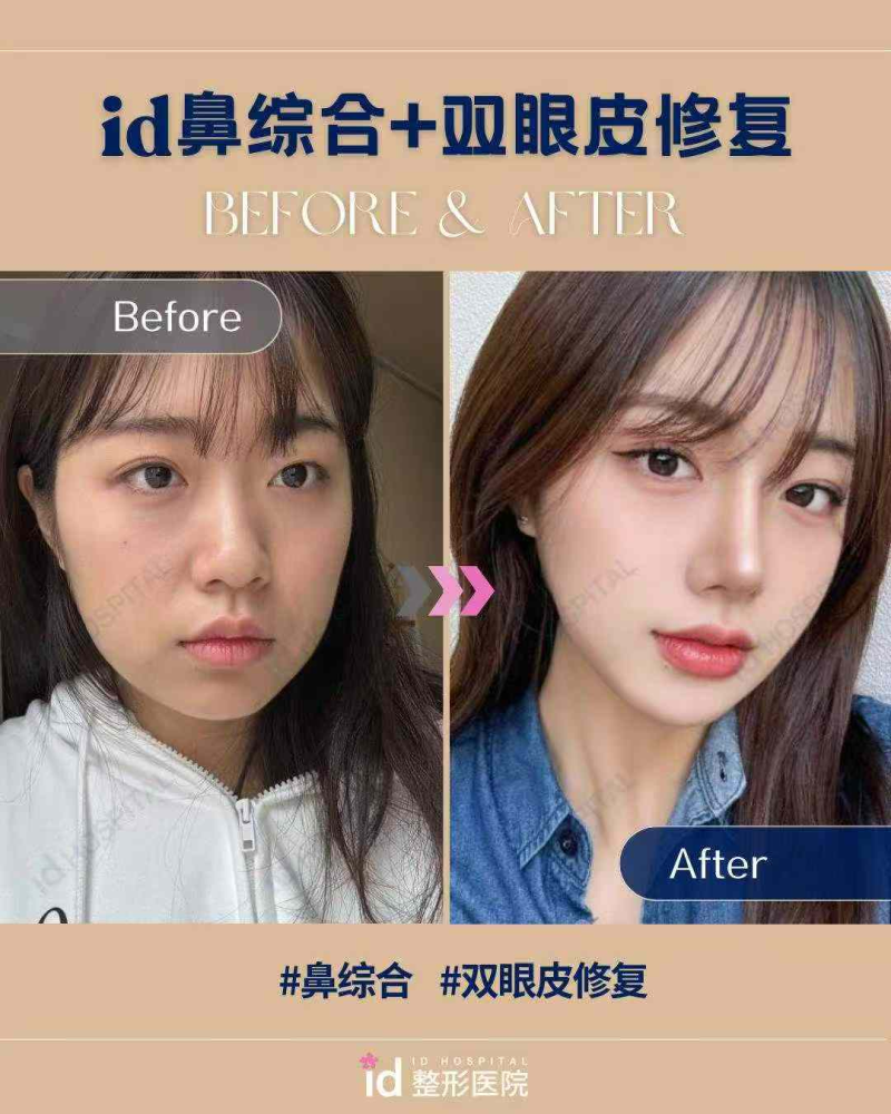 济南真荟美医疗美容诊所价格表：