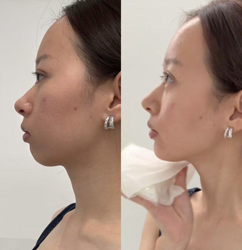 盐城仁美美容整形外科诊所擅长项目