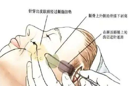 四、远期（老年阶段）的额外健康负担