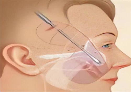 韩国medicalo医院擅长项目：